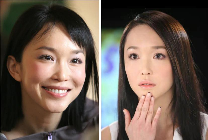 塌鼻子变美思路看这里,塌鼻梁怎么变漂亮