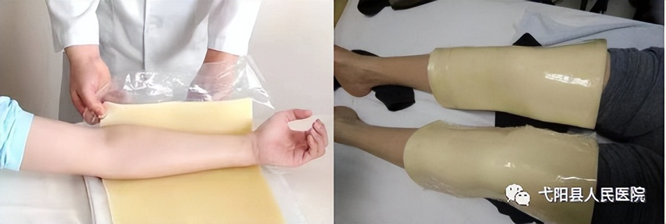 弋阳县人民医院康复科,弋阳县人民医院康复中心改造新建