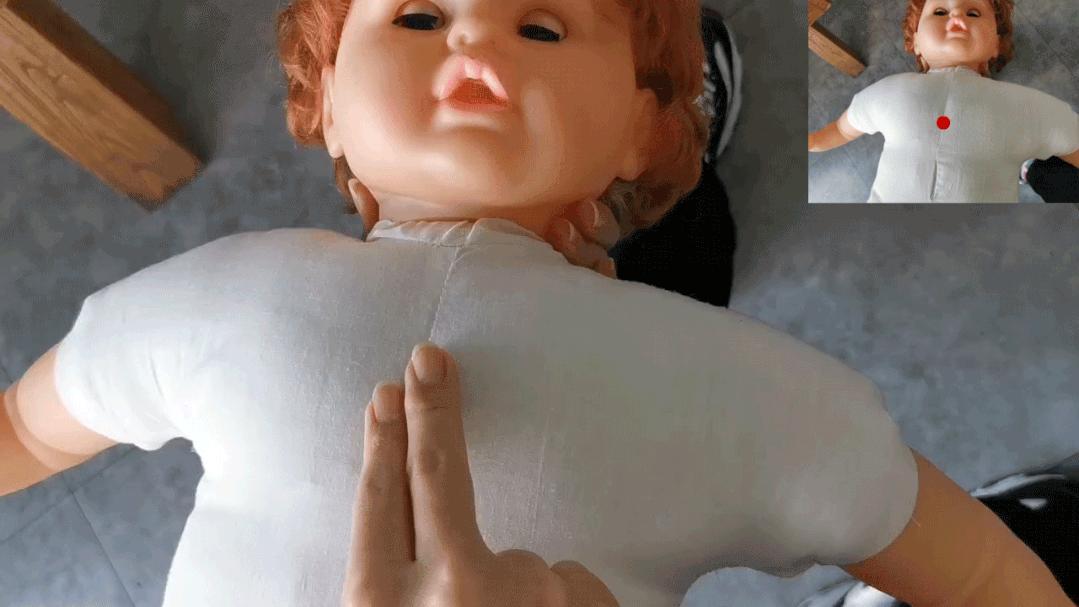 紧急救援海姆立克急救法,三分钟学会海姆立克急救法