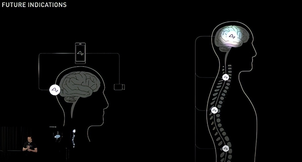 赛博格简介,赛博格作品