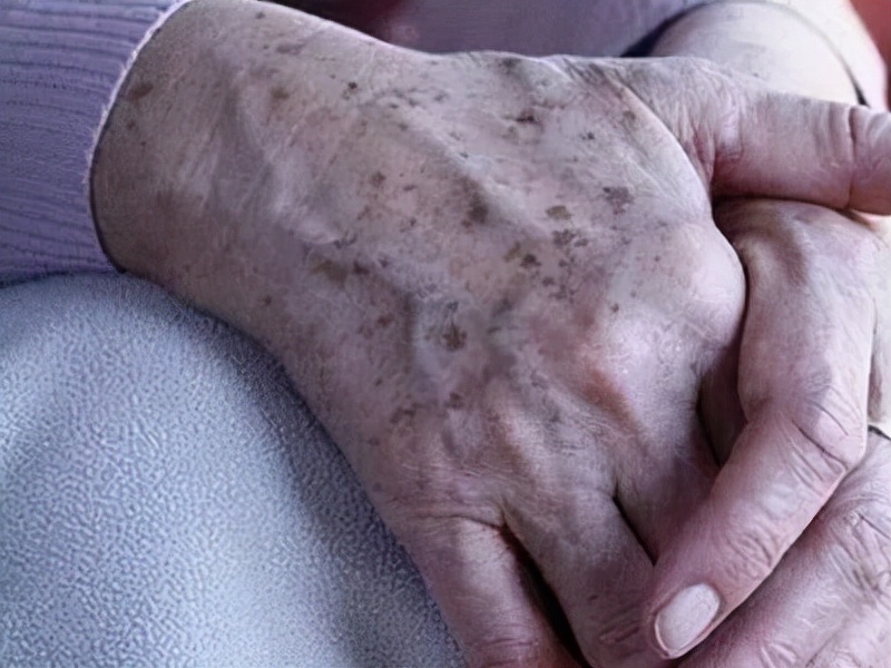 24岁长期熬夜老年斑,老年斑是熬夜的吗