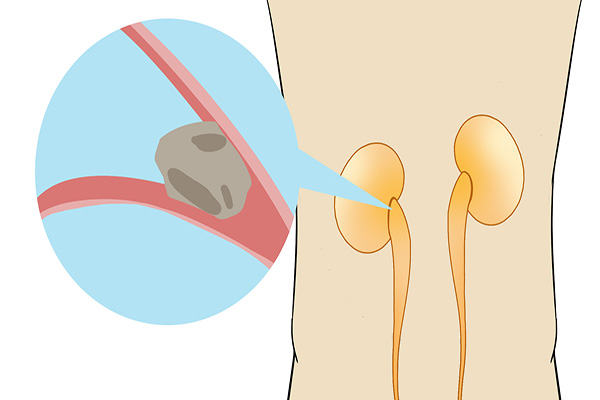 后背疼是以前劳累造成的吃什么药,后背酸痛要警惕四种原因