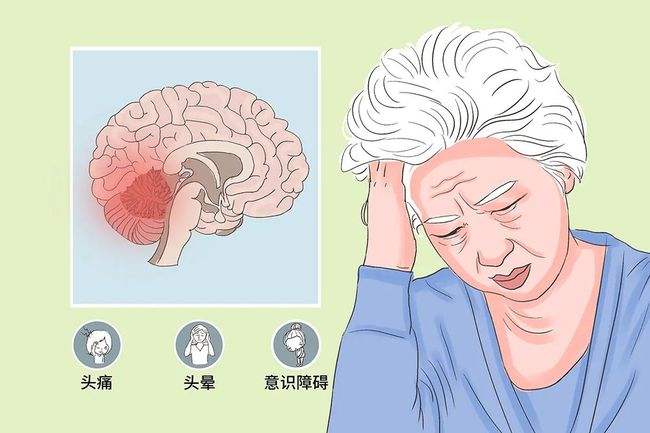 头部摔伤后怎么判断是否严重,摔伤科普视频