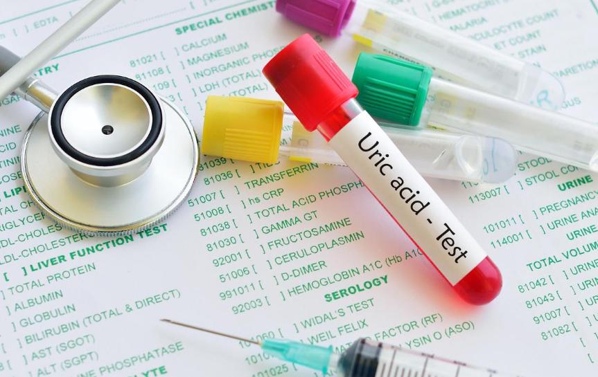 夏天出汗多排尿少对降尿酸影响吗,多运动尿酸能降低吗