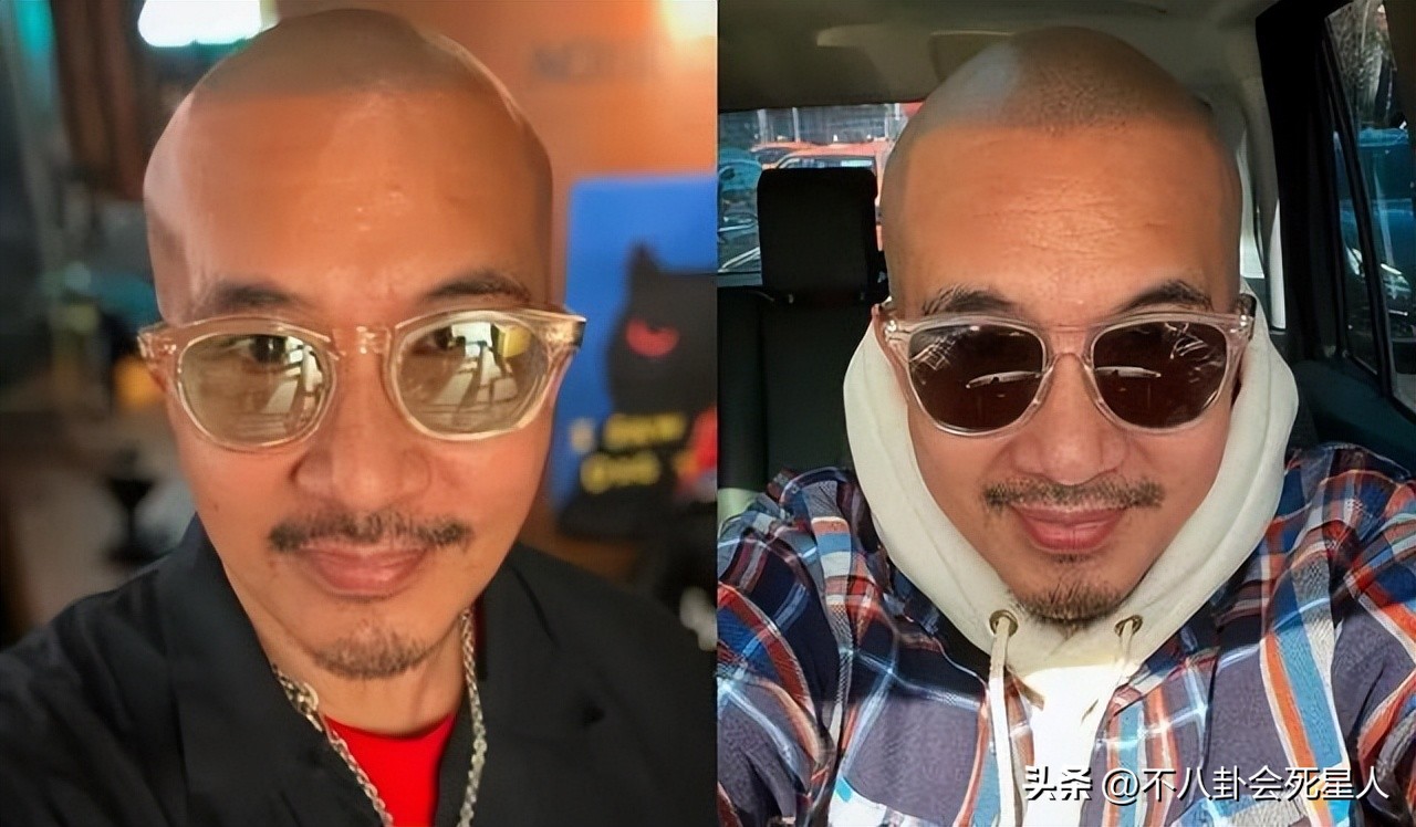 杨幂用生发液长出头发,杨幂的生发液长出头发了