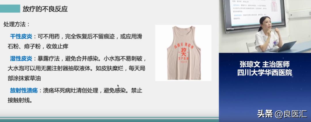 放疗后期反应有哪些症状,放疗后的副作用有哪几种