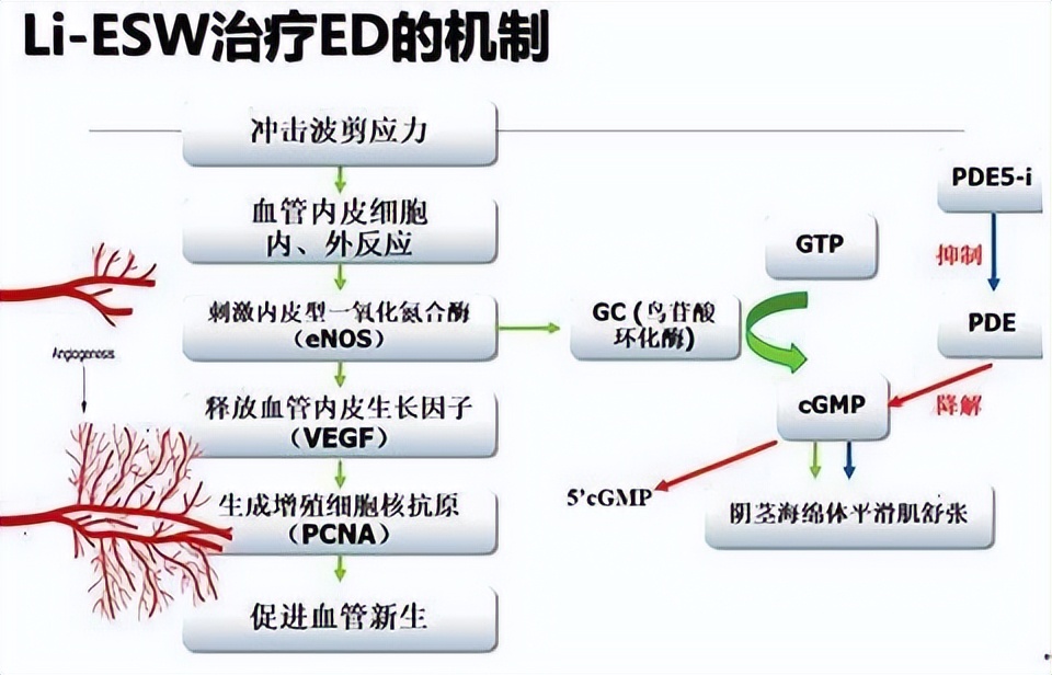 勃起功能障碍---别忽略了是糖尿病惹的祸怎么办..
