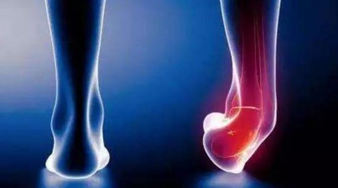 篮球脚踝扭伤怎么恢复爆发力,篮球运动中脚踝扭伤预防措施