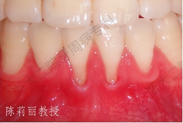 怎么拯救脱发小仙女,如何拯救牙齿上的黑洞