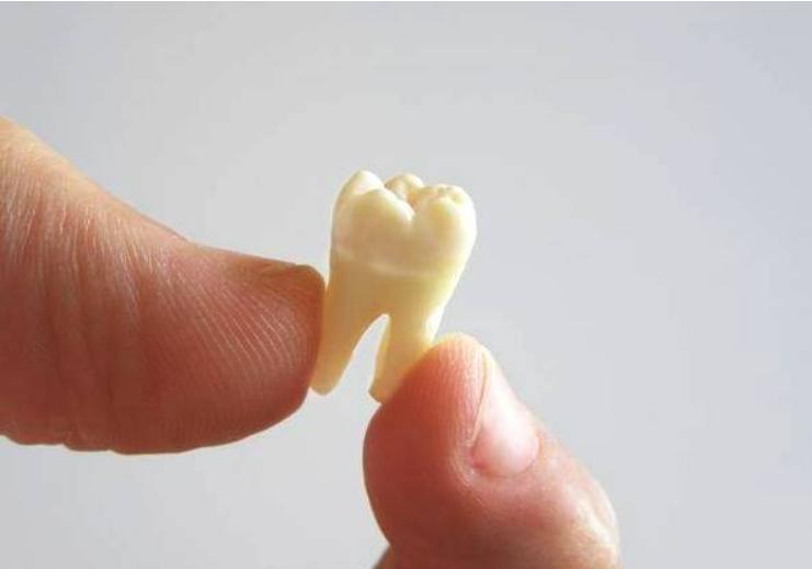 牙齿松了怎么治疗最好,牙齿松了怎么办教你如何快速恢复