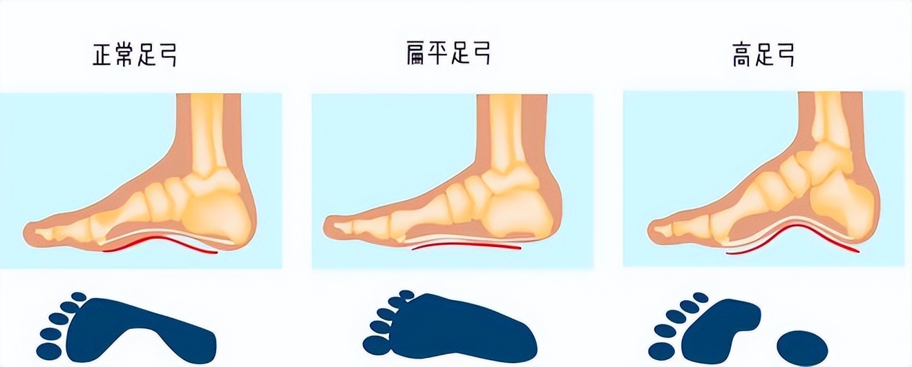 人的脚可以承受多大的力,人的脚有什么区别