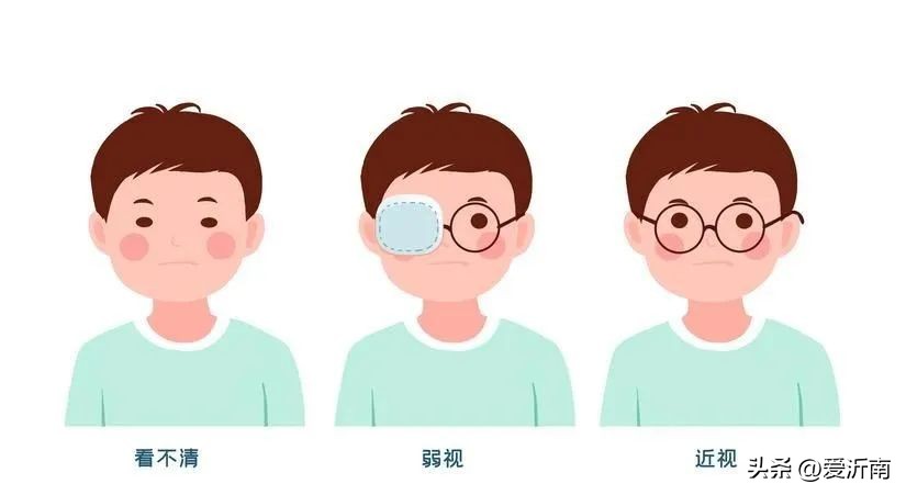 两只眼睛度数相差100度以上，这个问题不容忽视