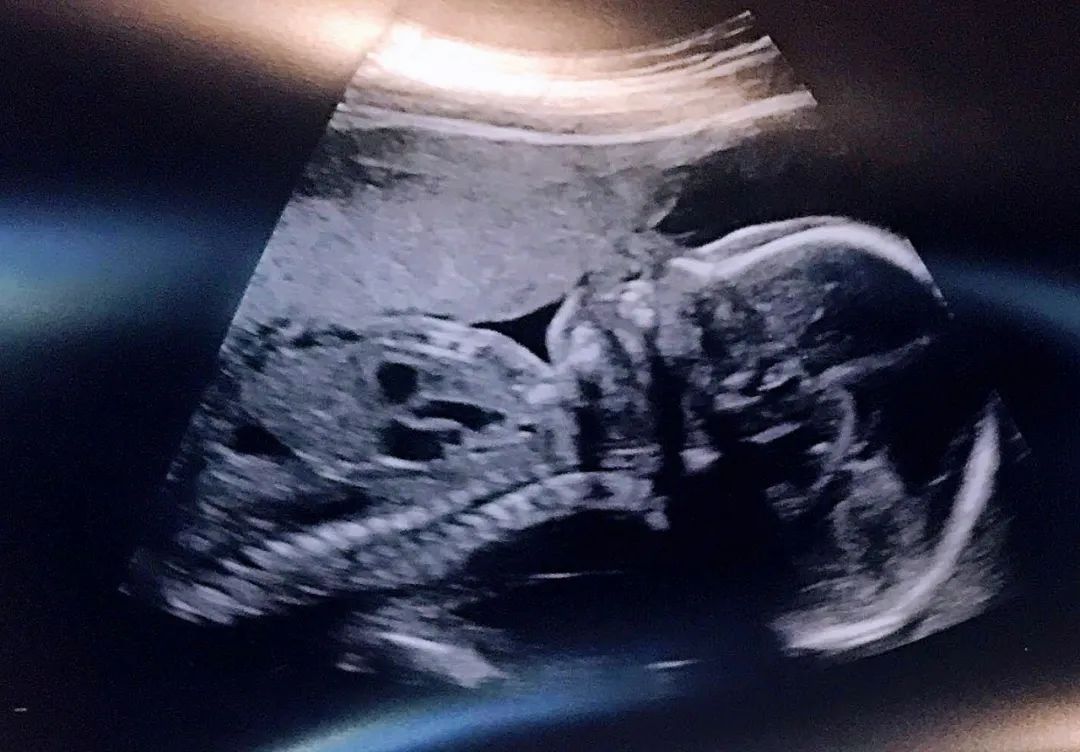 转念十年：我在华尔街穿越生死线