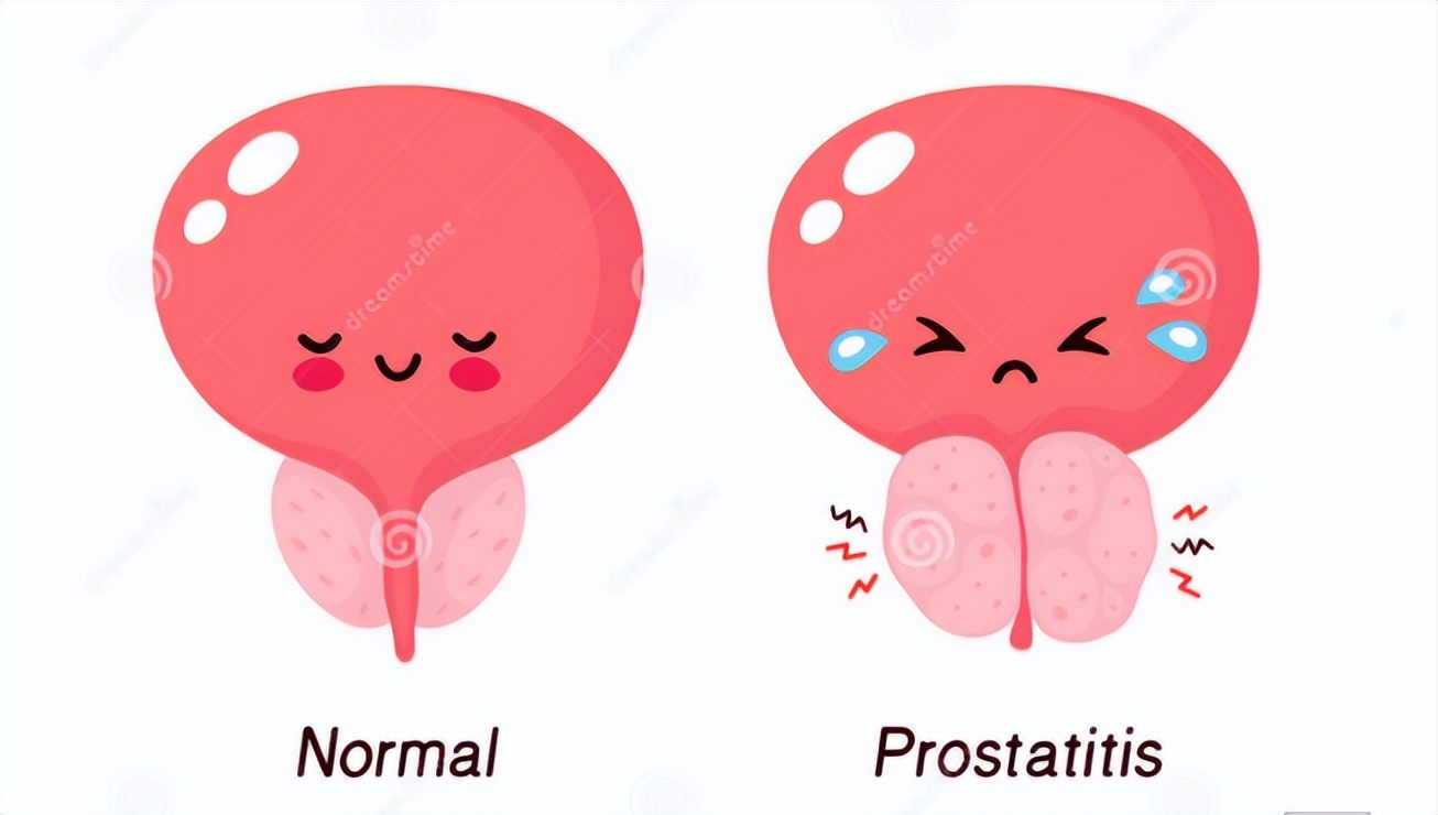 北医三院泌尿科专家治疗前列腺,关爱男性医学科普