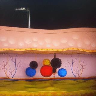 激光能量过大导致色沉,激光祛色沉会有危害吗