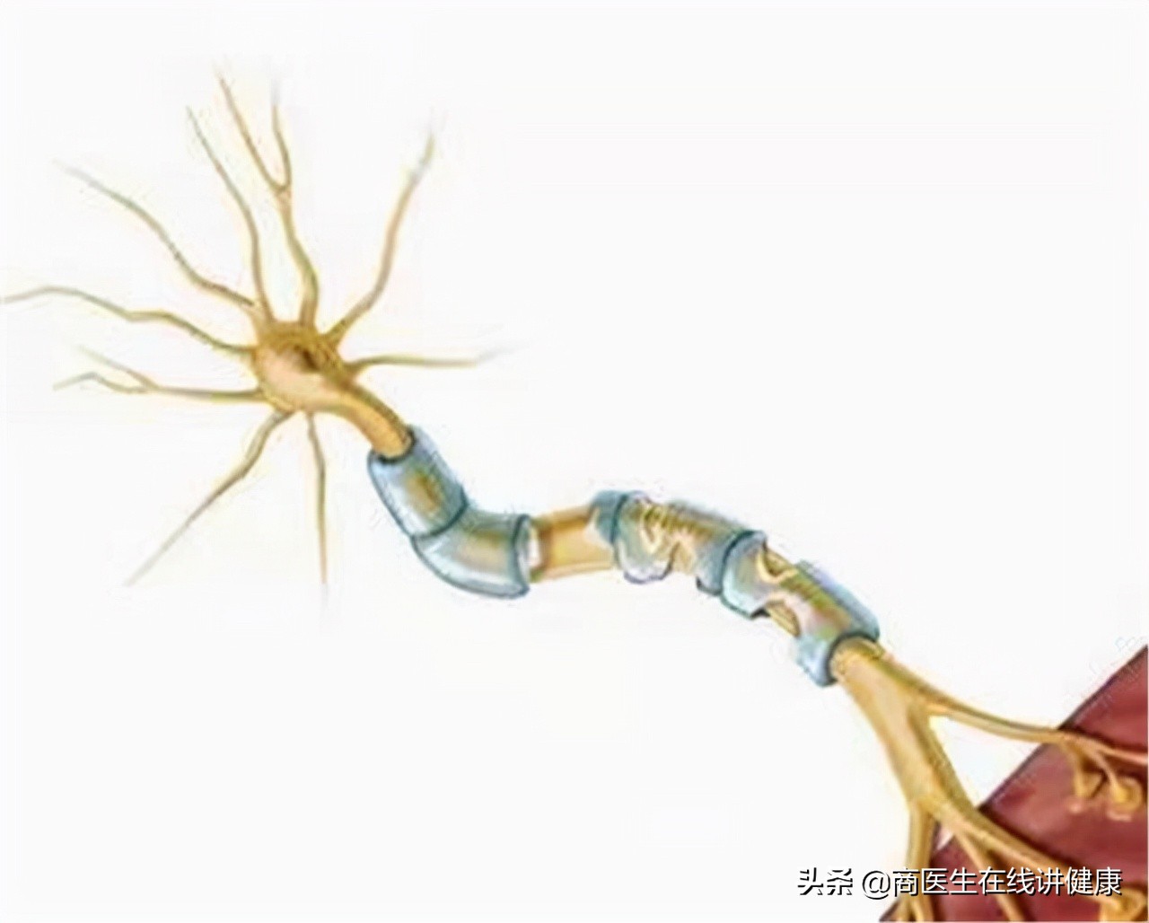 糖尿病人用甲钴胺好还是用b12好,糖尿病神经病变吃甲钴胺还是b12