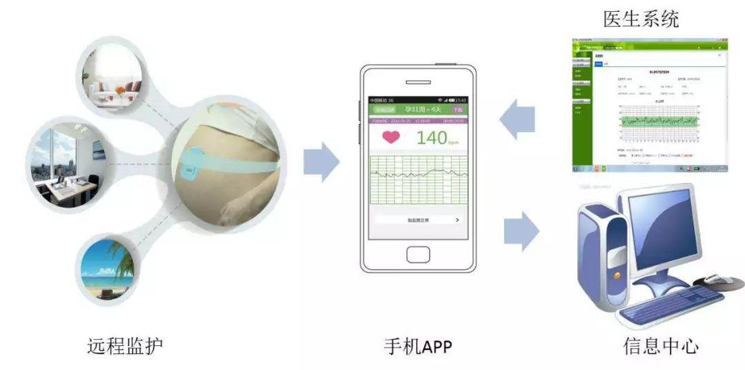 胎监结果胎儿宫内窘迫,孕39周胎儿宫内窘迫会怎么样