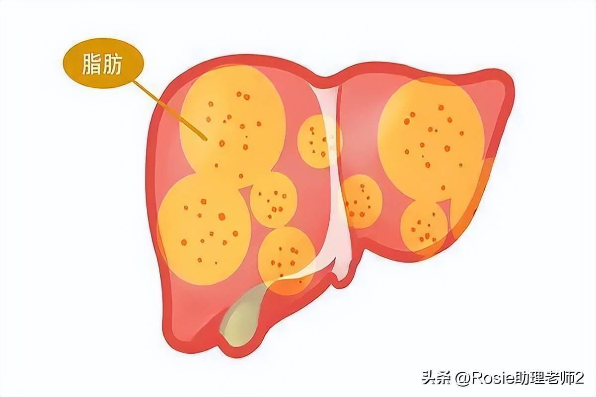 徐静蕾肚子怎么减肥,46岁徐静蕾腹部隆起有孕味