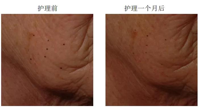 芙荑说成分|视黄醇驾到，干纹细纹全走开