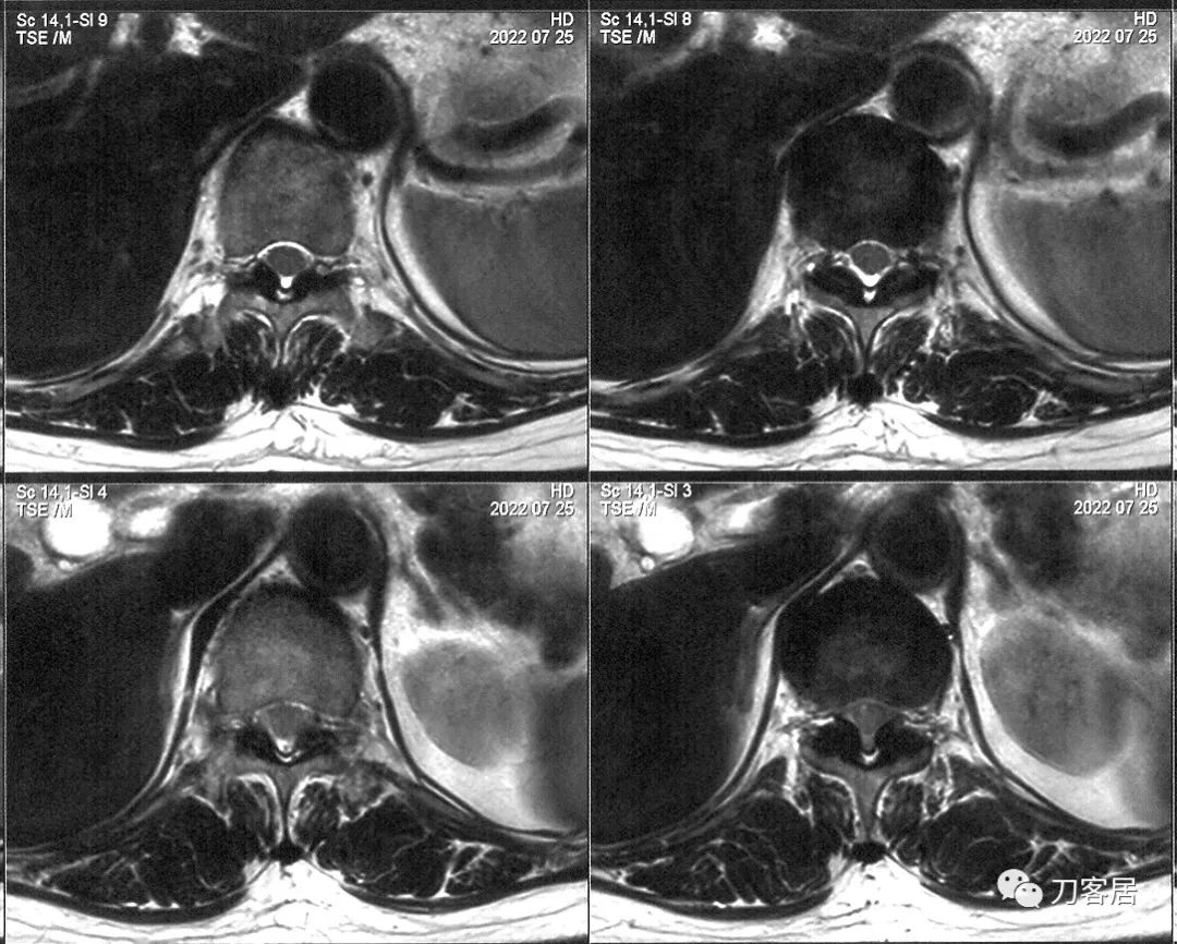 把你的脚放我腿上。医生不应该、也不会嫌弃患者脚臭