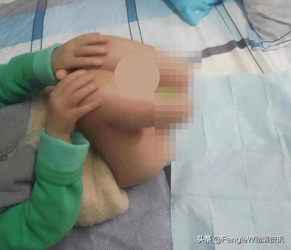 南通6岁男孩遭生母虐待警方通报,南通被生母虐待的男童永失双脚