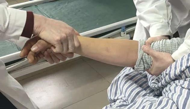 老年人腕部骨折手法复位石膏固定治疗方法指导