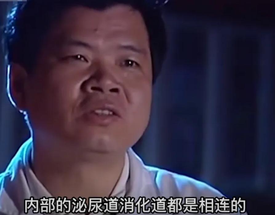 连体婴姐妹18年成功分离,连体婴姐妹成功分离后续