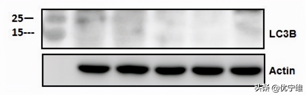 lc3自噬标记物,lc300有哪些隐藏功能