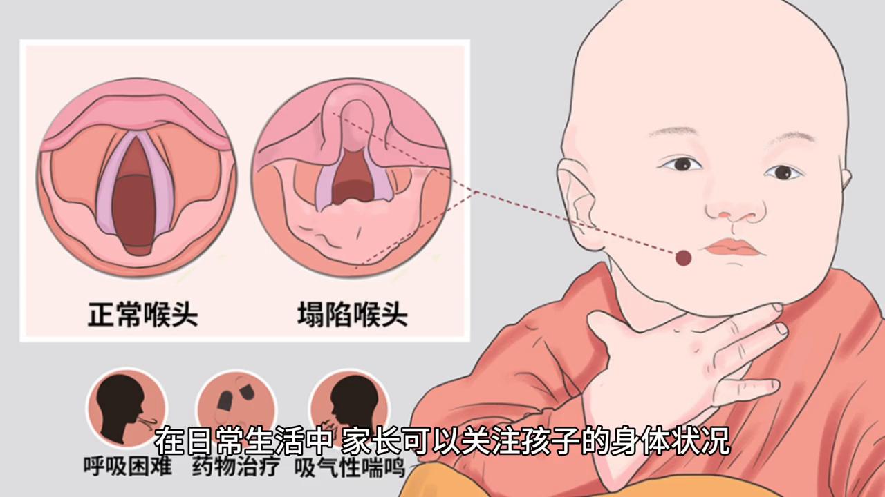 孩子说话慢怎么办,说话有气无力声音不洪亮
