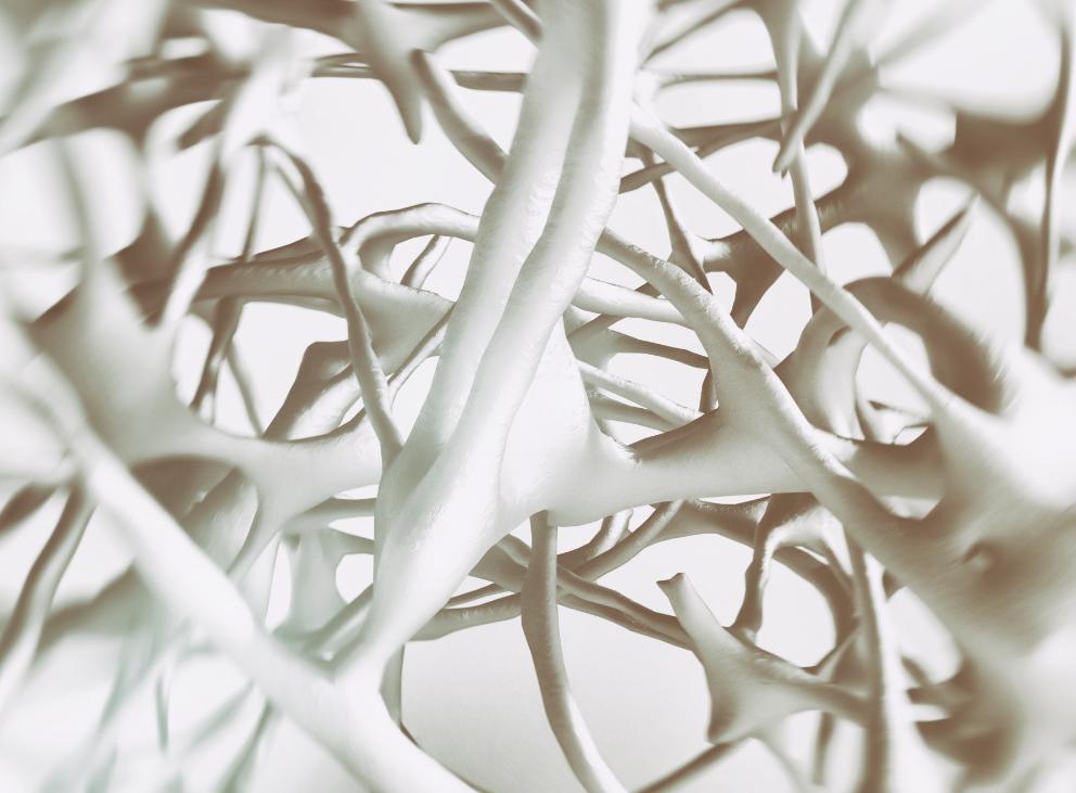 骨质疏松引起疼痛怎么好得快,严重的骨质疏松吃什么补得快