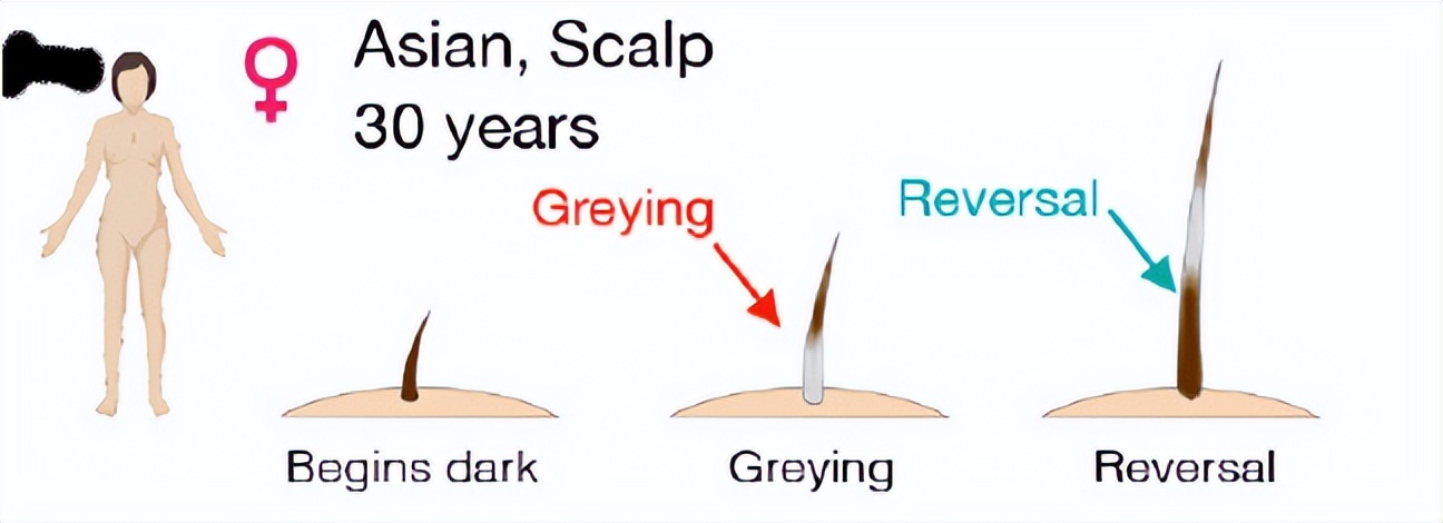 年龄老了缺乏营养会怎么样,白头发越来越多是缺乏什么吗