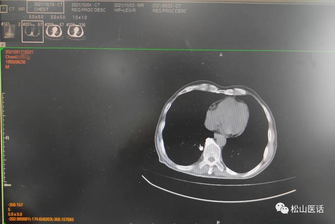 松山医话完整版,松山医话解说