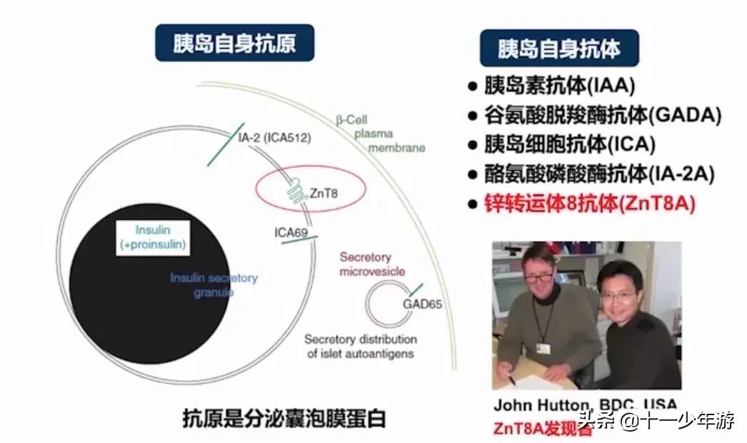 1型和2型糖尿病病因口诀,中医1型糖尿病治愈案例
