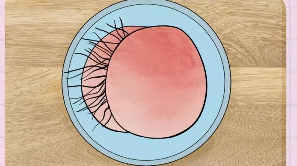 女性屁股上会长癣吗,女性臀部前面生毛怎么消除