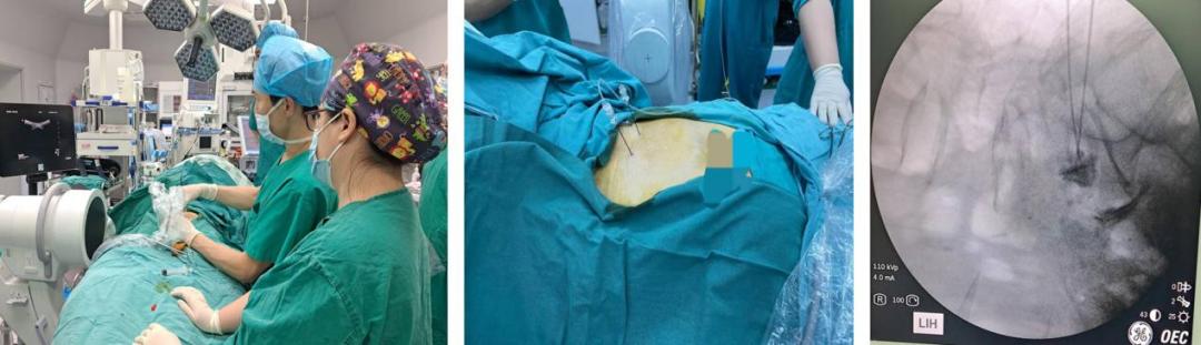 中山六院的肛肠外科在全国怎么样,中山六院肛肠专科医院