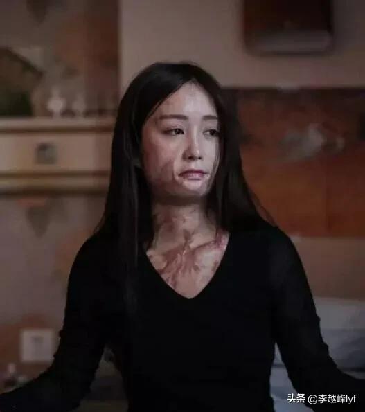 被泼了硫酸要赶紧用水洗吗,泼硫酸被泼用什么自救