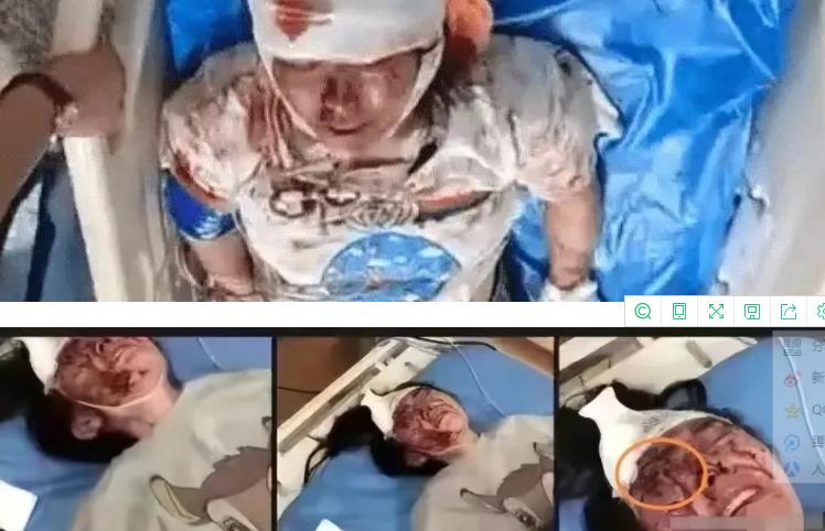 唐山打人轻伤二级鉴定标准,唐山事件轻伤二级