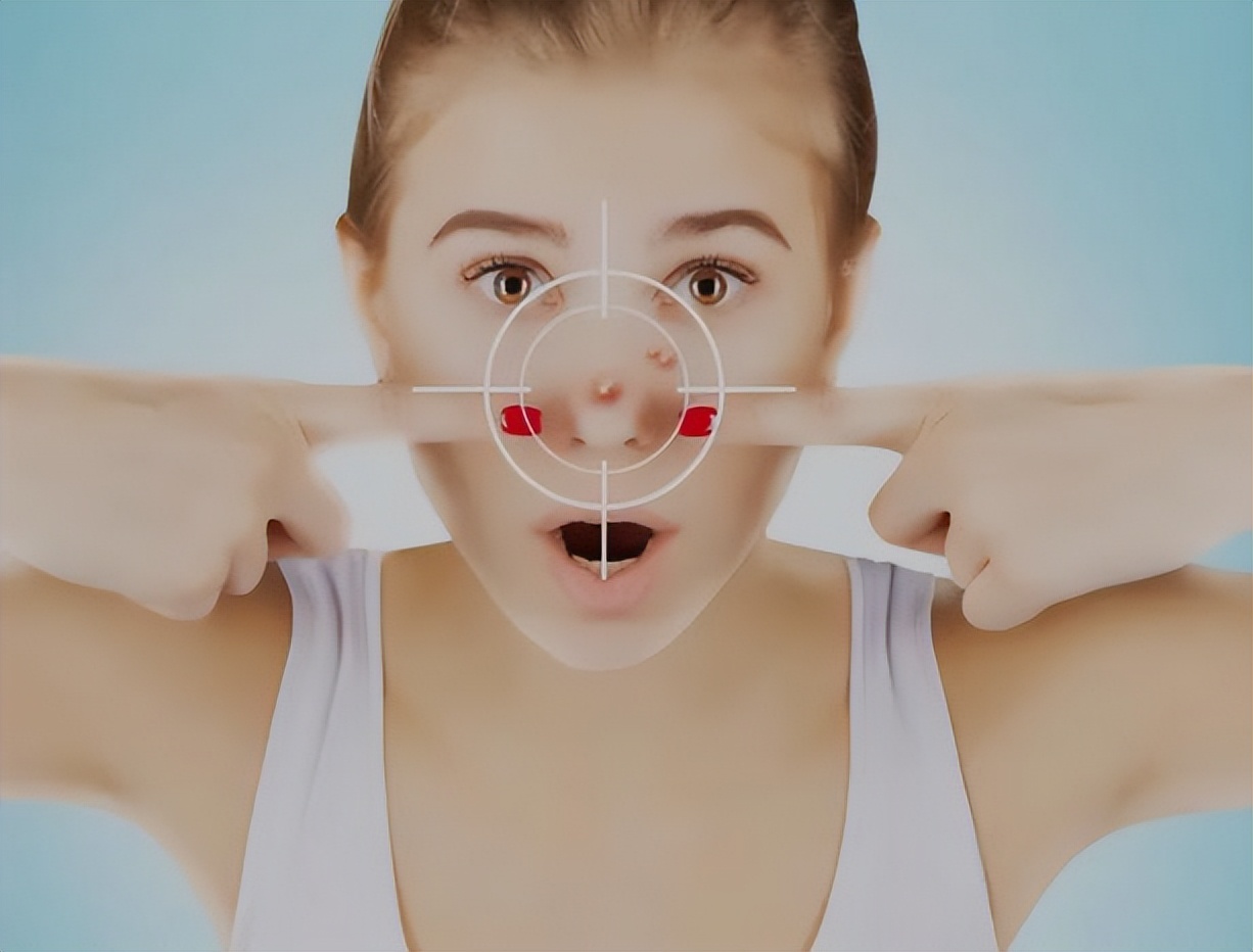 鼻子上螨虫挤出来的窟窿怎么办,鼻子里的螨虫有腥臭味是怎么回事