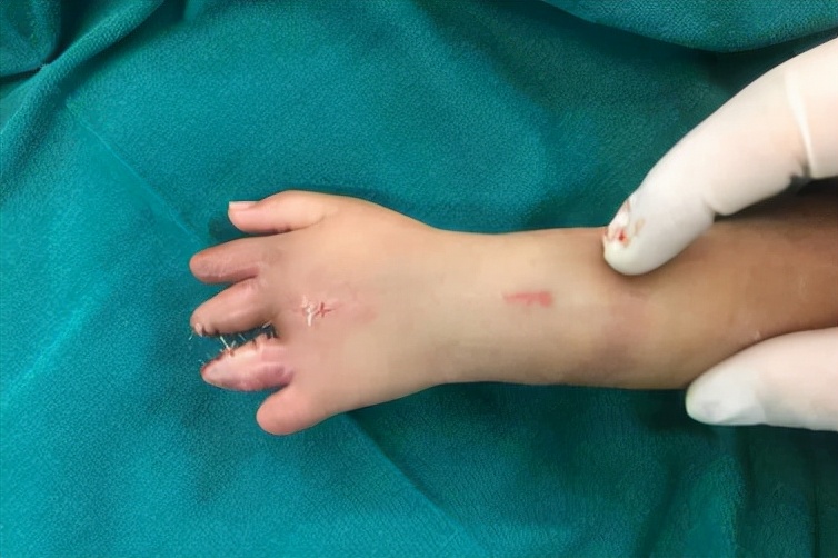 抗击疫情硬核技术,抗击疫情中的尖端技术