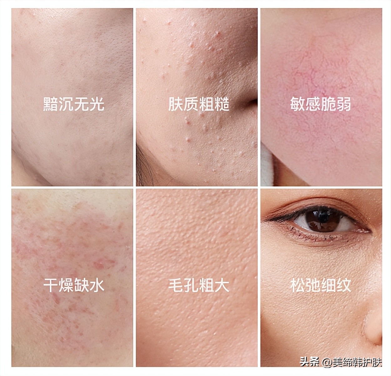 敏感肌泛红用什么护肤抗皱,如何正确认识敏感肌