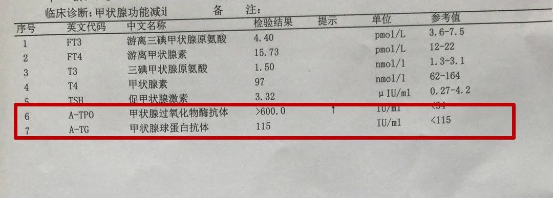 16岁女孩桥本氏甲状腺炎治疗,14岁女孩桥本甲状腺炎能治愈吗