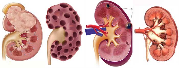 泌尿外科常见病诊疗指南,泌尿外科疑难病例讨论全集