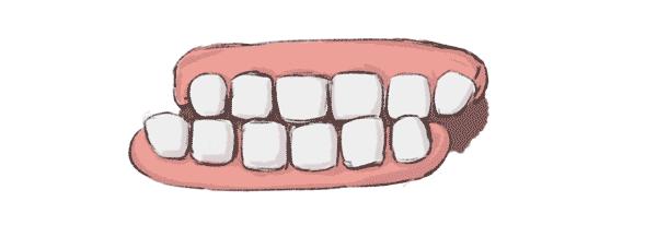 室友磨牙导致我也磨牙了,室友磨牙越来越严重了