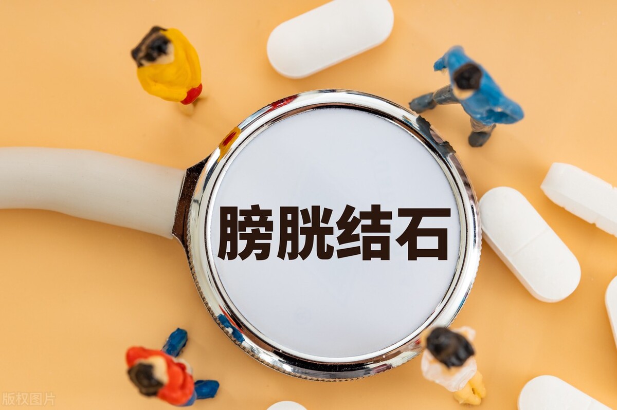 膀胱结石的治疗方法,膀胱结石的治疗费用纳入医保吗