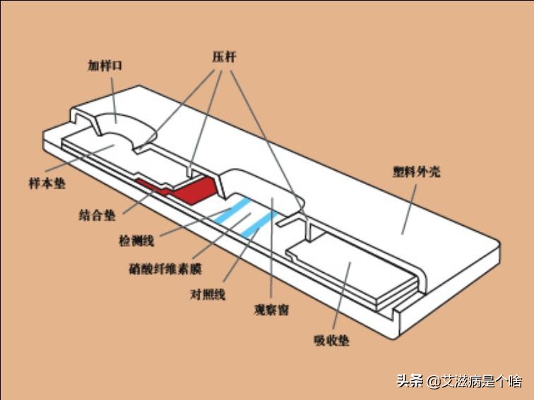 雅培艾滋病试纸不加缓冲液准确吗,艾滋病试纸缓冲液是什么