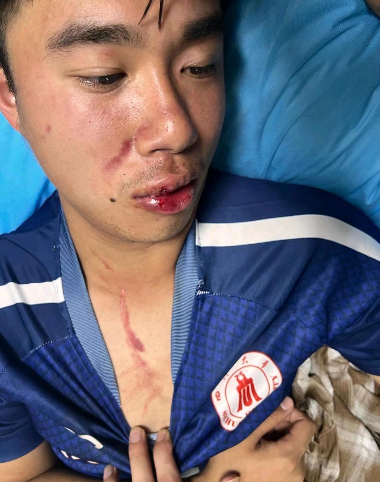 校霸挑衅体育生被群殴,湖北高校冲突事件后续打人男子