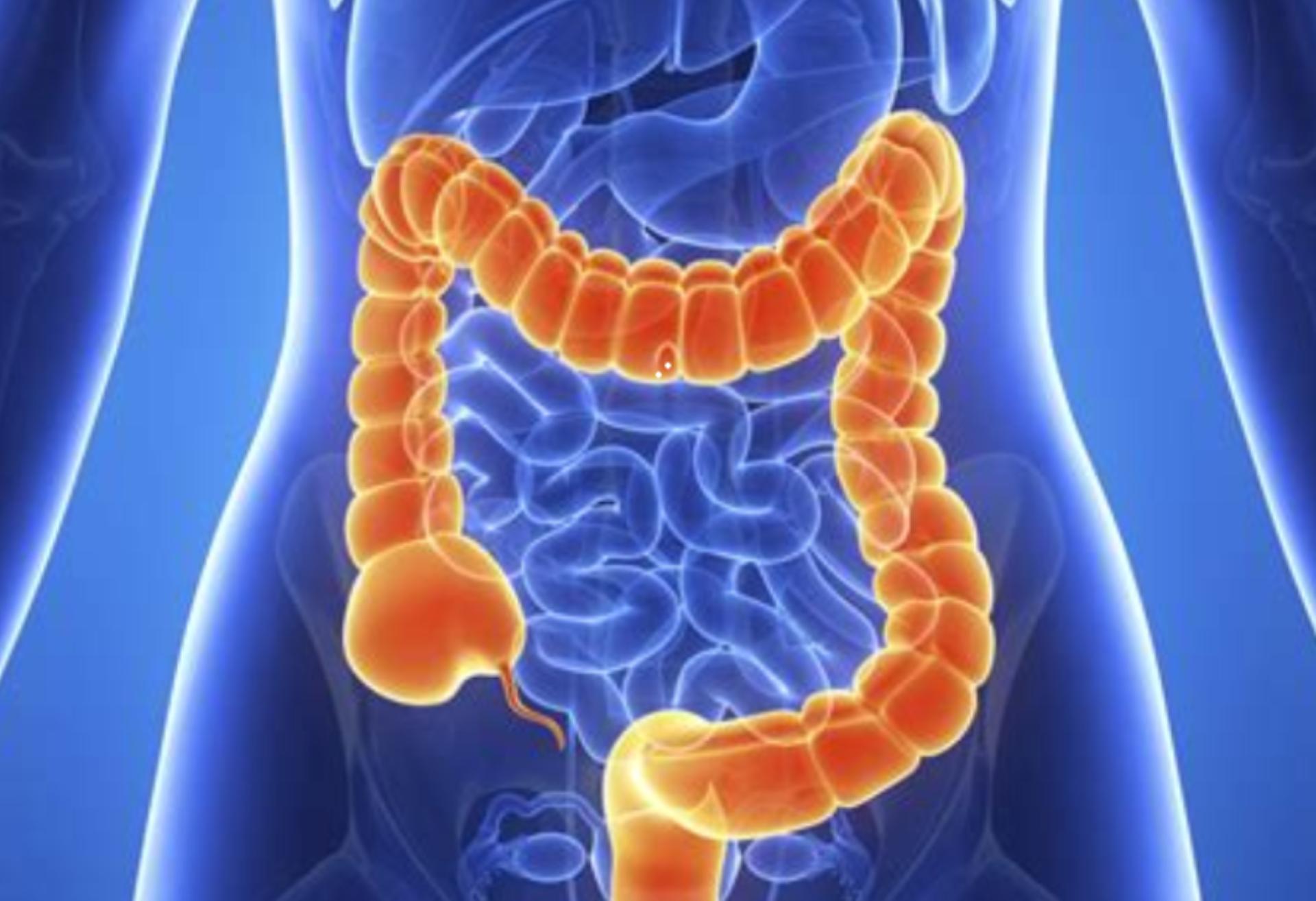 结肠长息肉是什么原因造成的,结肠息肉切除肚子还疼是什么原因