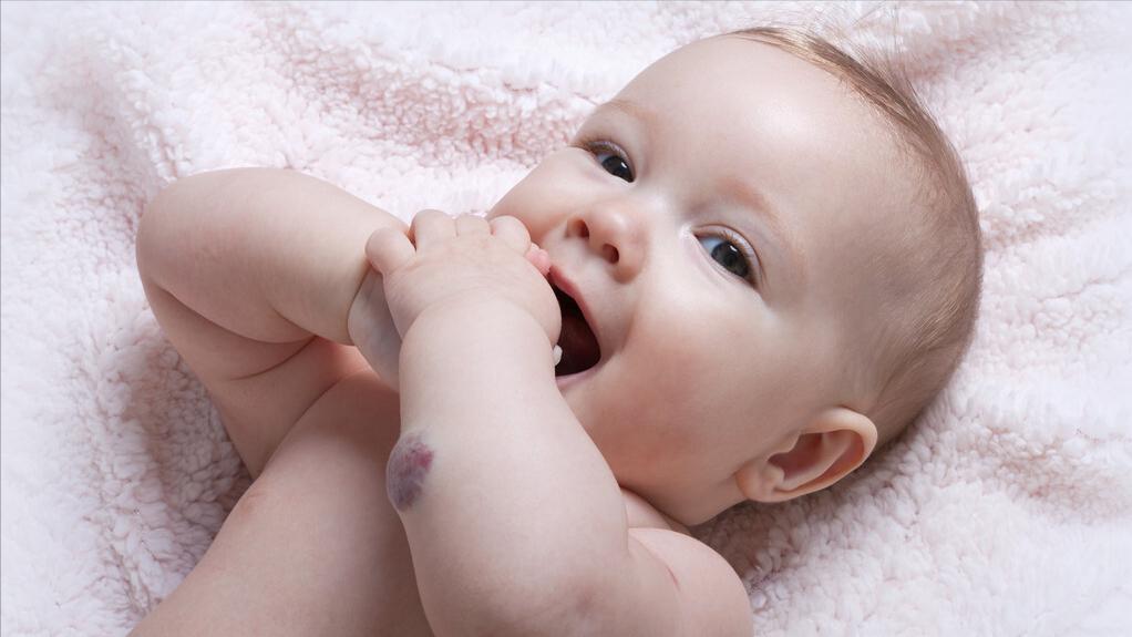 普萘洛尔可以用来治疗血管瘤吗,普萘洛尔治疗血管瘤的注意事项