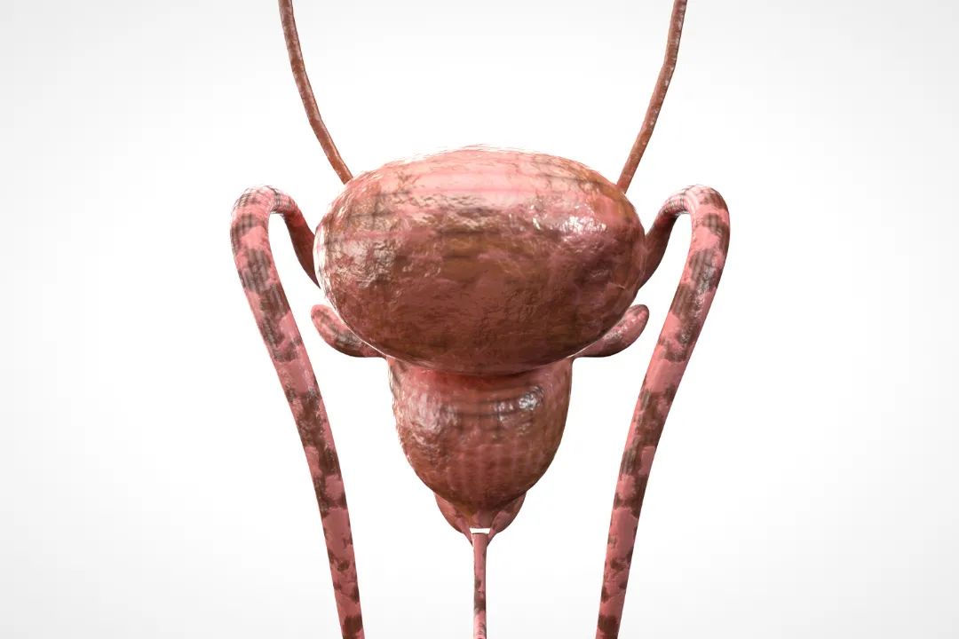 前列腺增生与年龄关系,前列腺大小与psa值关系