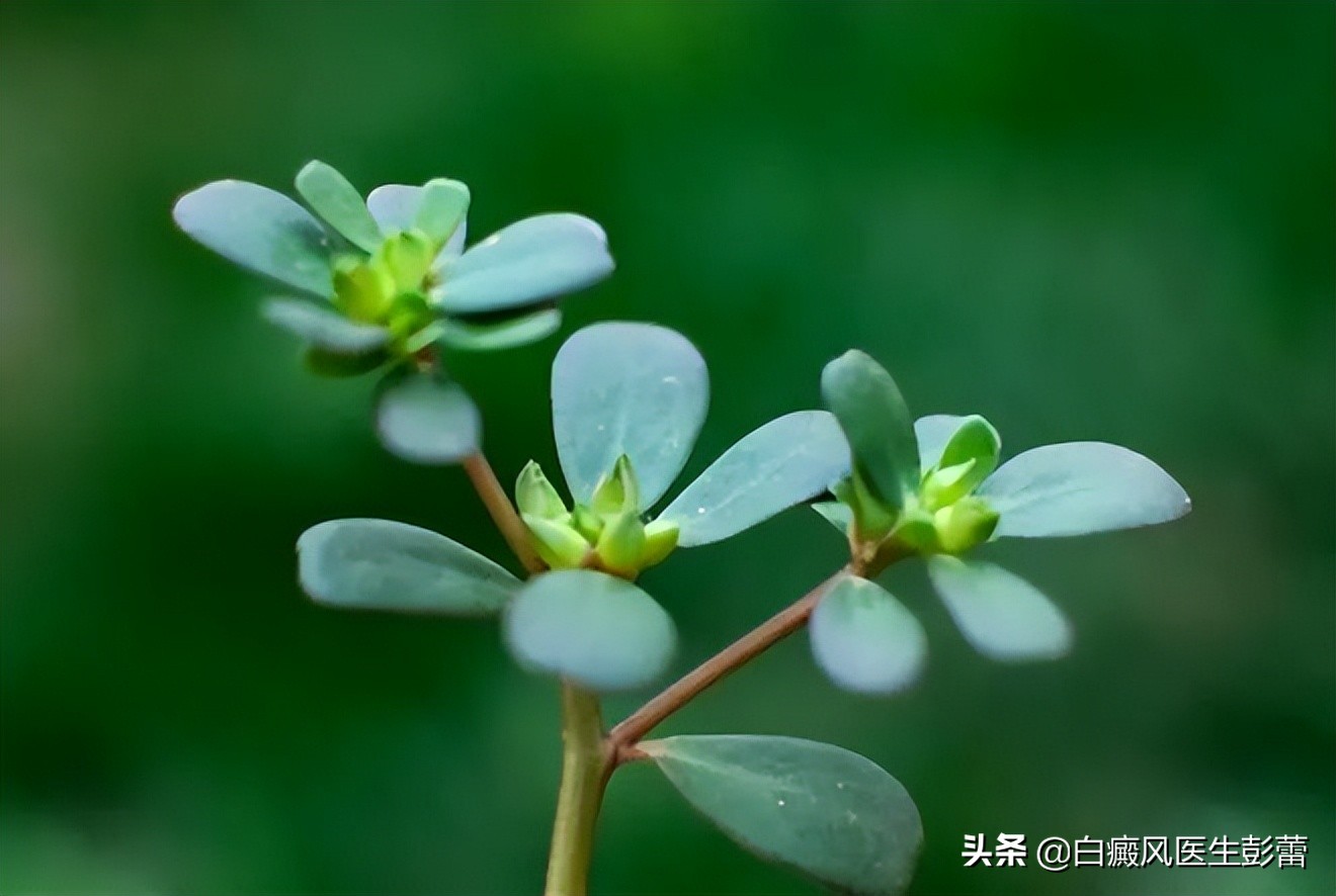 马齿苋治疗白癜风27例疗效观察,马齿苋的作用和功效治白癜风